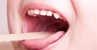 an-lisis-sobre-el-streptococcus-pyogenes-arrojaron-tranquilizadores