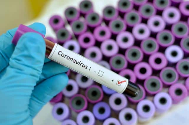  Dos hombres y una mujer fallecieron por coronavirus y suman 63 los decesos