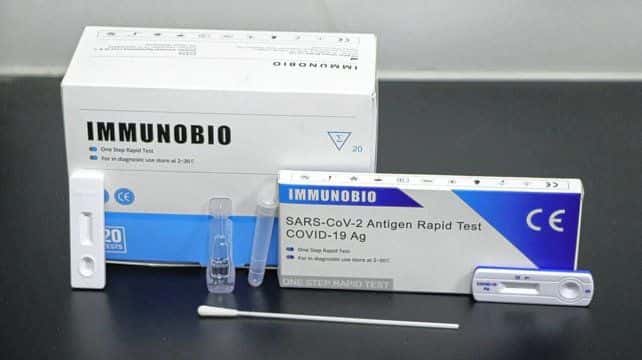 Coronavirus: autorizan la venta en farmacias del test rápido