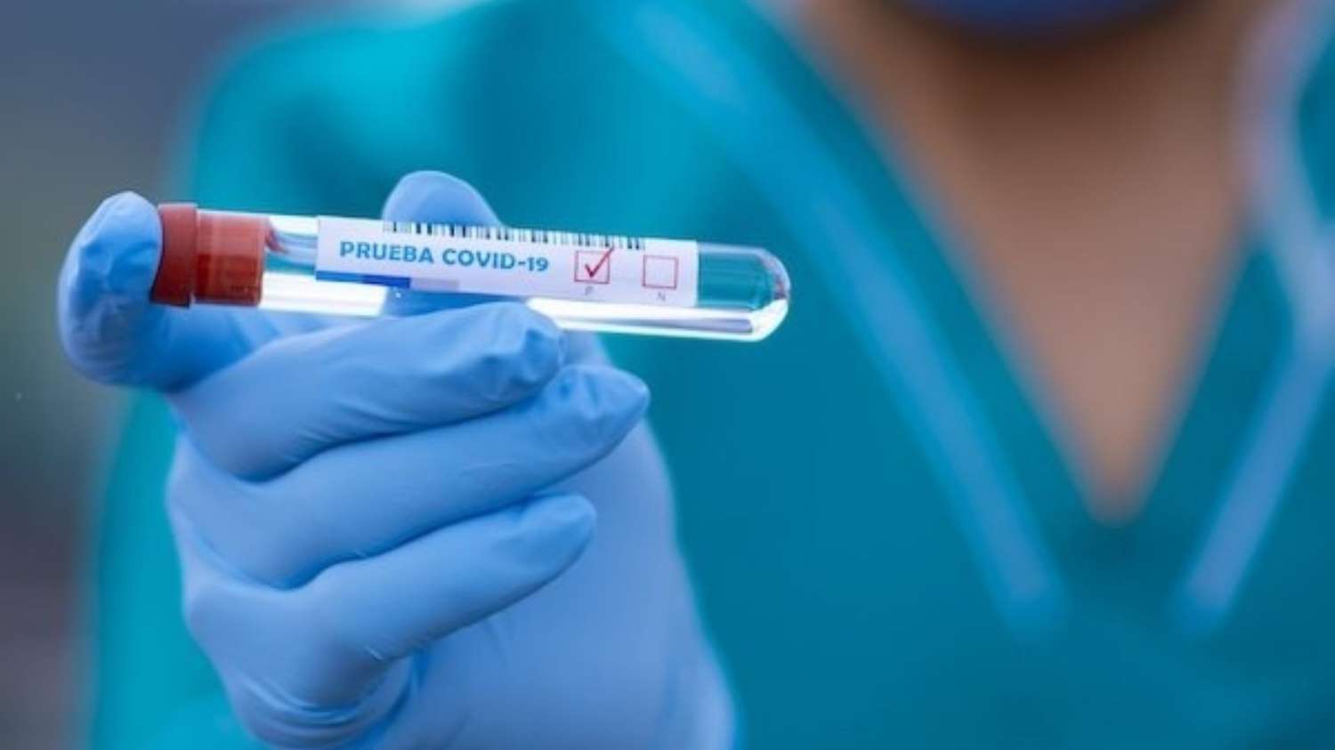 Coronavirus: autorizan la venta en farmacias del test rápido