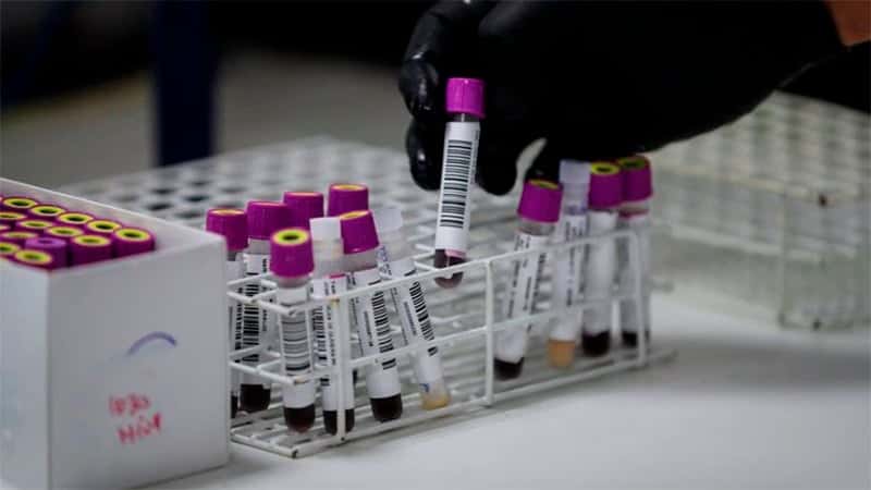 Una argentina se habría curado de VIH por inmunidad natural