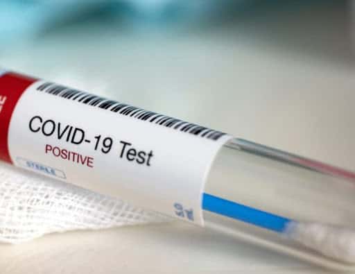 Cuáles son los nuevos criterios para definir un caso positivo de Covid-19 sin testeo