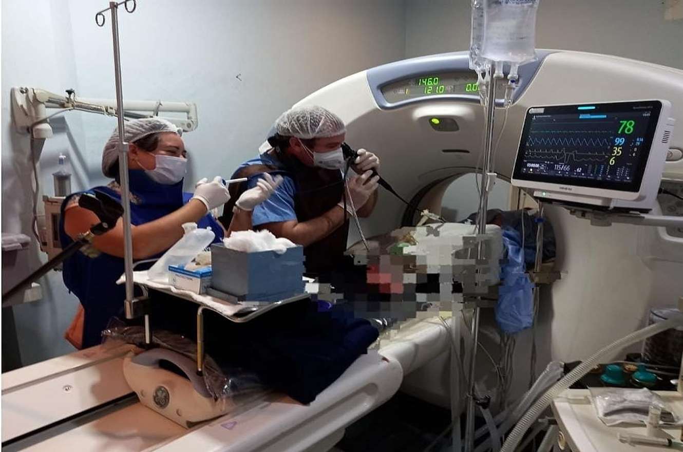 Clínica Uruguay: primer fibrobroncoscopía para detectar cáncer de pulmón